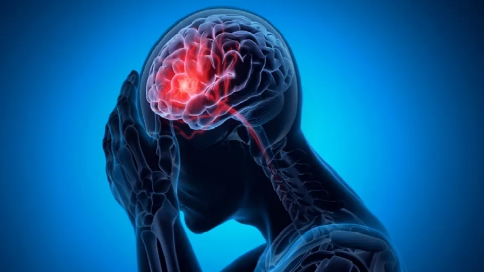 سکته مغزی؛ علائم و اقدامات