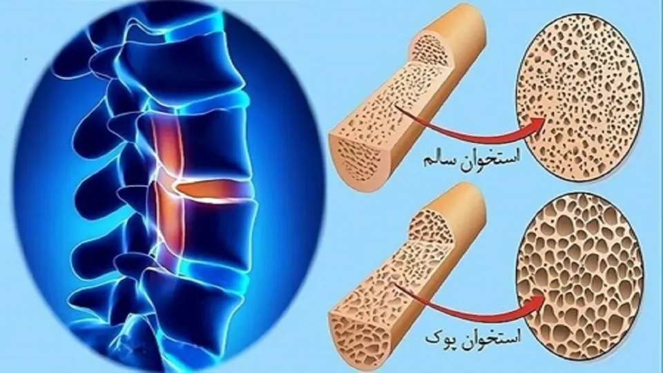 لبنیات بالاترین میزان جذب کلسیم در بدن/ ساخت ۶۰ درصد از بافت استخوان در کودکی